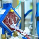 ECMO